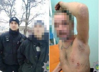 В Краматорске от ножевых ранений едва не умер бомж