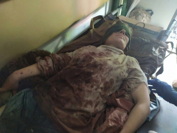 На Донбассе на мине подорвалась 35-летняя женщина