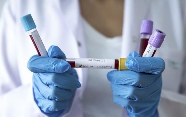 В Украине 3372 человека заражены коронавирусом — Минздрав