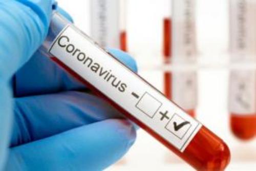 В Луганской области  за минувшие сутки выявили 110 новых заболевших COVID-19