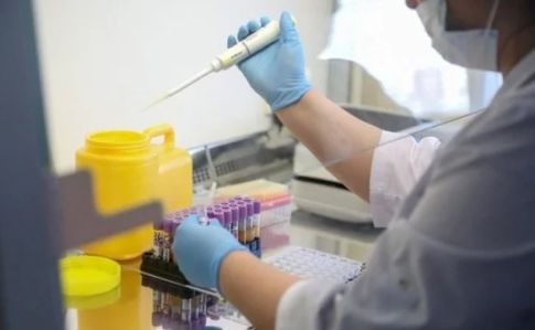 Лабораторные исследования на коронавирус новым методом планируют в Луганской области