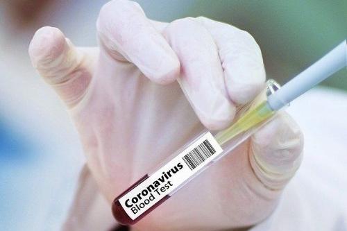 В Донецкой области рекордное количество новых случаев коронавируса за сутки