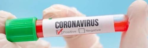 В Луганской области есть  возможность бесплатно сдать тест на коронавирус