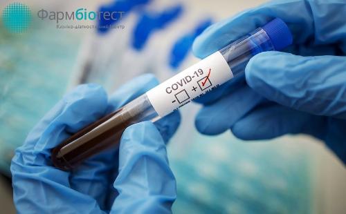 Тесты на коронавирус в Станице Луганской будет проводить  «Фармбиотест» из Рубежного 