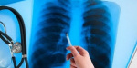 В Краматорске выросло число заболевших туберкулезом