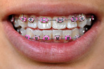 С какими проблемами чаще всего пациенты приходят к стоматологу	