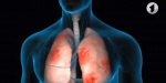120 случаев заболеваний пневмонией с начала года зафиксировано в Константиновке