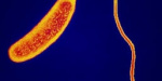 На Мариупольском пляже обнаружили холероподобный вибрион