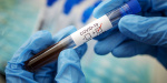 Заболеваемость коронавирусом в Украине за последние сутки