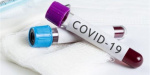 COVID-19: за сутки количество заразившихся увеличилось на 47