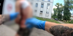Чоловіка пораненого під час обстрілу Торецька госпіталізували в Костянтинівку